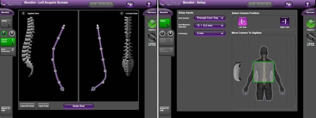 Software Display of Spinal Rod Bending Program