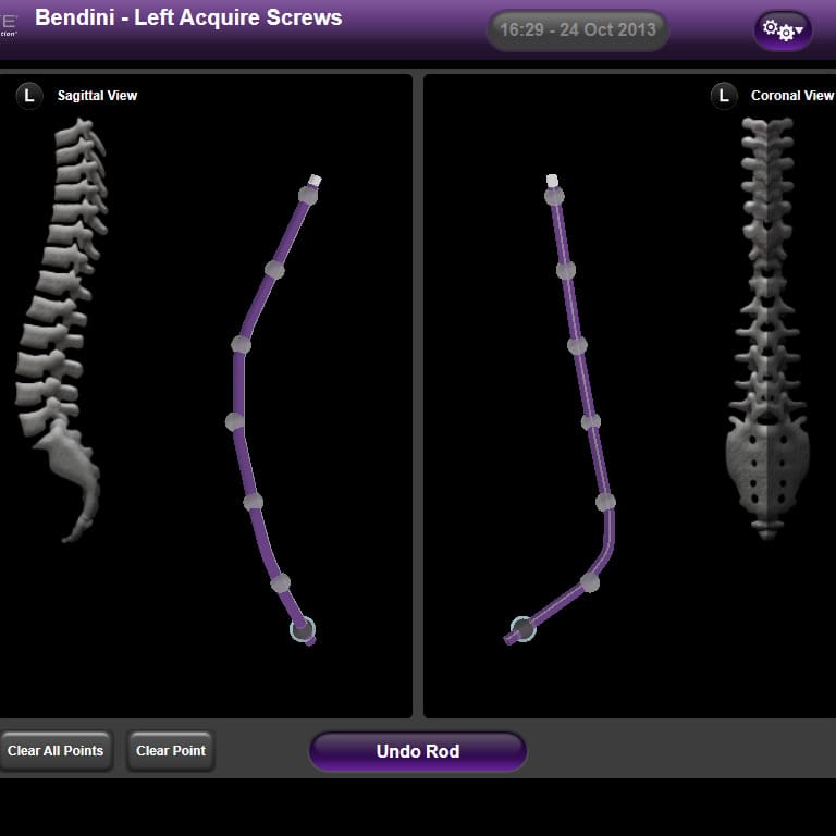 Spinal-rod bending software